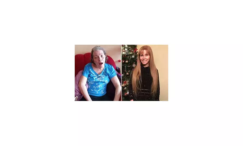 Florida BBL Nightmare: Woman Fights for Life After 'Butt Lift' Surgery Catastrophe in Miami