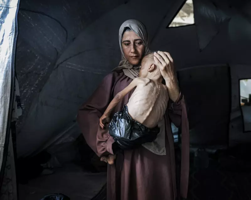 Heartbreaking Image of Malnourished Gaza Child Sparks Global Outcry