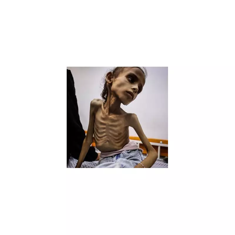 Heartbreaking Image of Skeletal 9-Year-Old Girl Sparks Outrage Over Yemen Crisis