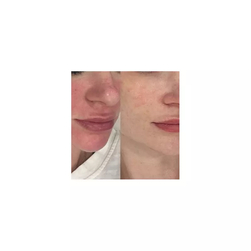 How a Peptide Cream Ruined My Skin Barrier – A Cautionary Tale