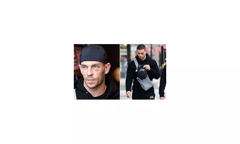 Joey Essex's Shocking Transformation: Battered and Bruised After Controversial Misfits Boxing Win Sparks Fan Fury