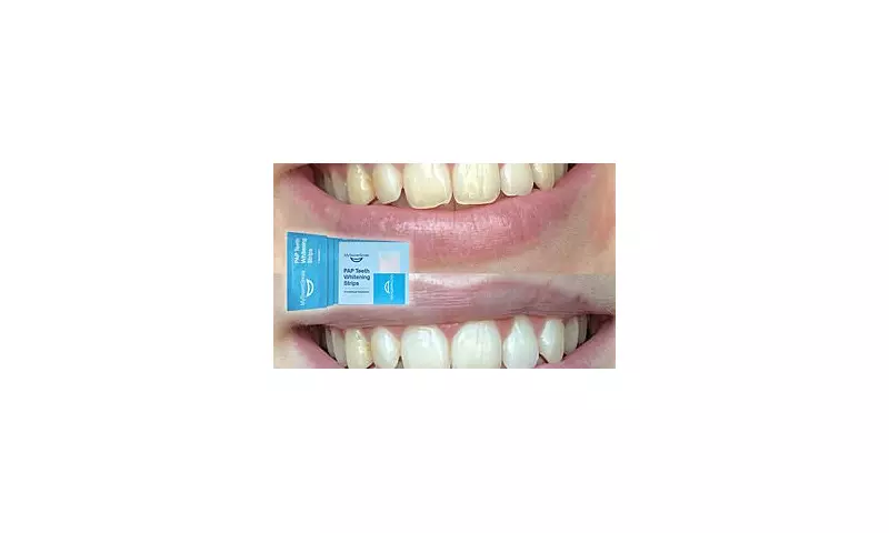 MySweetSmile Peroxide-Free Whitening Strips: A Safe and Effective Way to Brighten Your Teeth