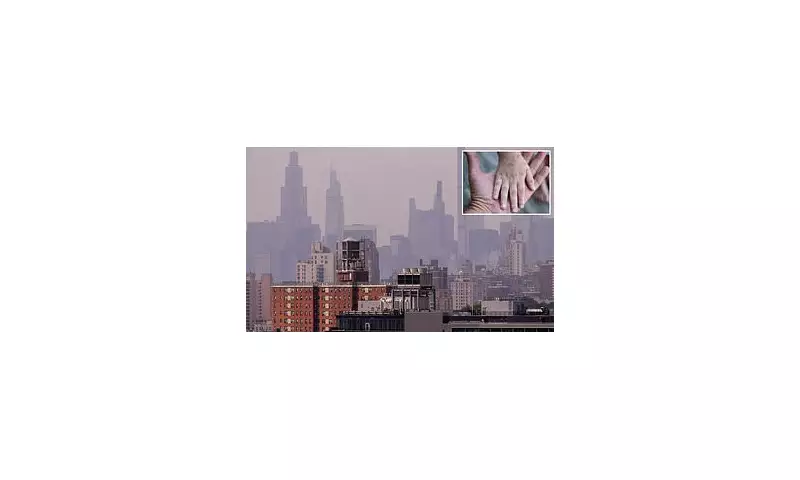 New York City Braces for Second Contagious Virus Outbreak as Cases Spread to Neighbouring States