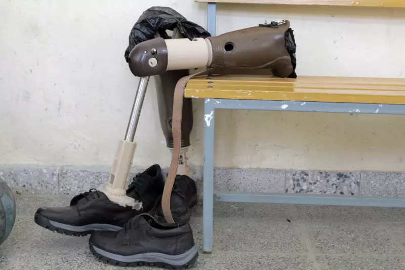 NHS Breakthrough: Revolutionary Brain Implant Ends Phantom Limb Pain for Amputees