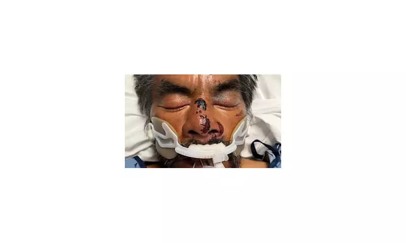 Shocking Footage: Homeless Man Brutally Beaten Outside LA Hospital in Disturbing Attack