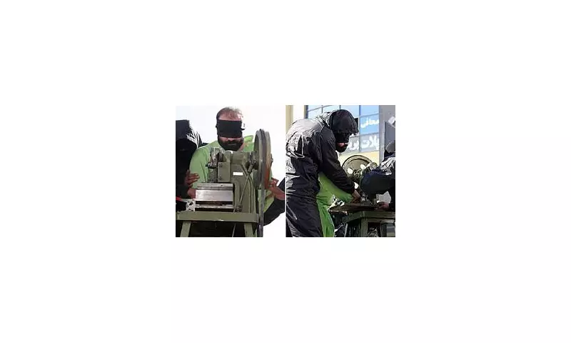 Shocking Punishment in Iran: Thieves Have Hands Amputated Under Harsh Islamic Law