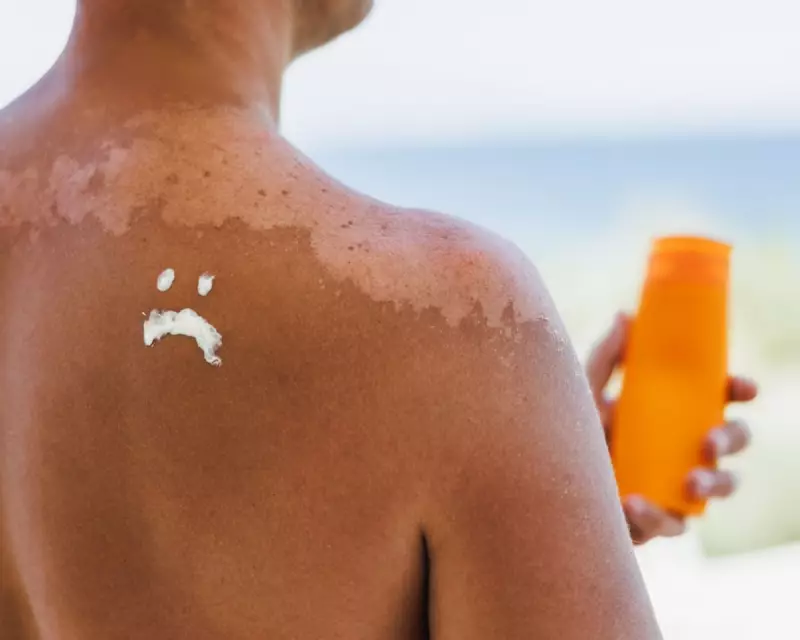 Sunscreen vs. the Sun: Which Poses the Greater Health Risk?