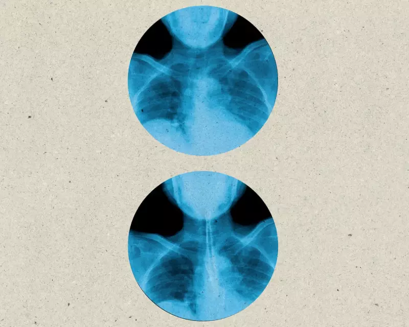 The Hidden Health Hazard: How Correct Swallowing Could Save Your Life, According to Experts