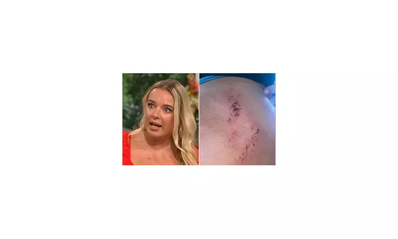 TikTok Shapewear Nightmare: Mum's Baby Shower Gift Leaves Her 'Scarred For Life'