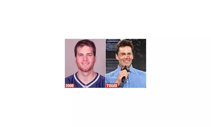 Tom Brady's Shocking Transformation: Plastic Surgeons Analyse His Changing Face