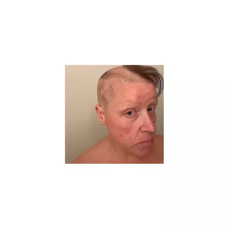 Woman's Shocking Hair-Pulling Habit Led to a Pile the Size of a Tennis Ball – The Hidden Dangers of Trichotillomania