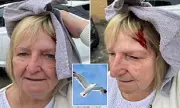 70-Year-Old Woman Hospitalised After Savage Seagull Attack in Coastal Town