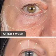 Best Anti-Ageing Eye Creams to Banish Wrinkles and Dark Circles in 2024