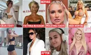 Chloe Ferry Leads Celeb Trend: Why Stars Are Reversing Cosmetic Surgery Procedures
