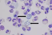 Deadly Brain-Eating Amoeba Claims Life in Missouri Lake: Urgent Health Warning Issued
