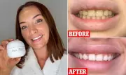 Dentists Are Stunned: This £29.99 Whitening Kit Delivers 'Stunning' Results In Just 7 Days