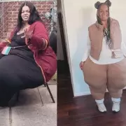 From 51 Stone to a New Life: How One Man Overcame Obesity Against All Odds