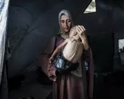 Heartbreaking Image of Malnourished Gaza Child Sparks Global Outcry