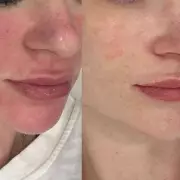 How a Peptide Cream Ruined My Skin Barrier – A Cautionary Tale