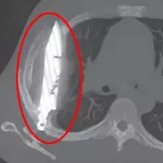 Man's Shocking Discovery: He's Been Dead for 13 Years Due to Bureaucratic Blunder