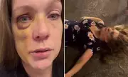 Shocking Street Attack in Cincinnati Leaves Woman with Severe Trauma