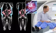 The Skinny Person's Health Risk: How 'Hidden' Fat Around Your Organs Is Secretly Ageing Your Heart