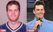 Tom Brady's Shocking Transformation: Plastic Surgeons Analyse His Changing Face