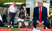 Trump Health Speculation Erupts Online: Armchair Experts Analyse Hand Bruising and Swollen Ankles