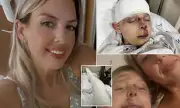 Turkey Hair Transplant Holiday Nightmare: Mother's Bargain Surgery Leaves Her Scalp Burning and Scarred