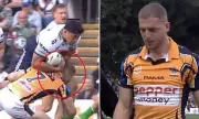 Wests Tigers Star Apologeti Kepaoa Rushed to Hospital After Sickening Head Clash | NRL Injury Scare