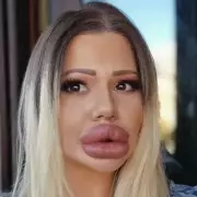 Woman With World's Biggest Lips Reveals Shocking New Look – You Won't Believe Your Eyes!