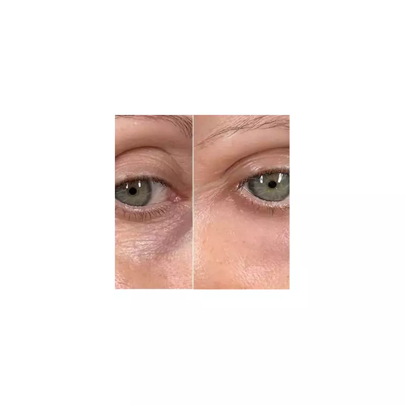 Banish Dark Circles For Less: This £10 Eye Cream Is A Game-Changer