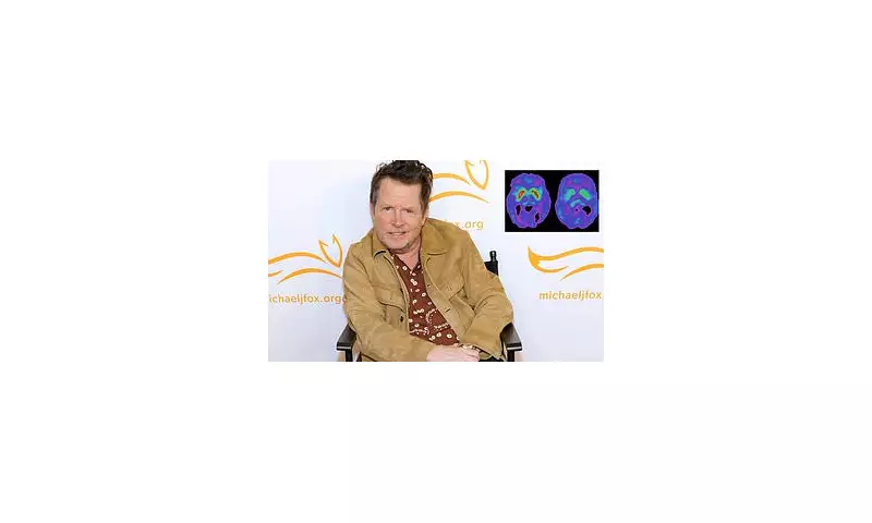 Common 'Harmless' Virus Could Be Secretly Driving Parkinson's Disease Crisis, Groundbreaking Study Reveals