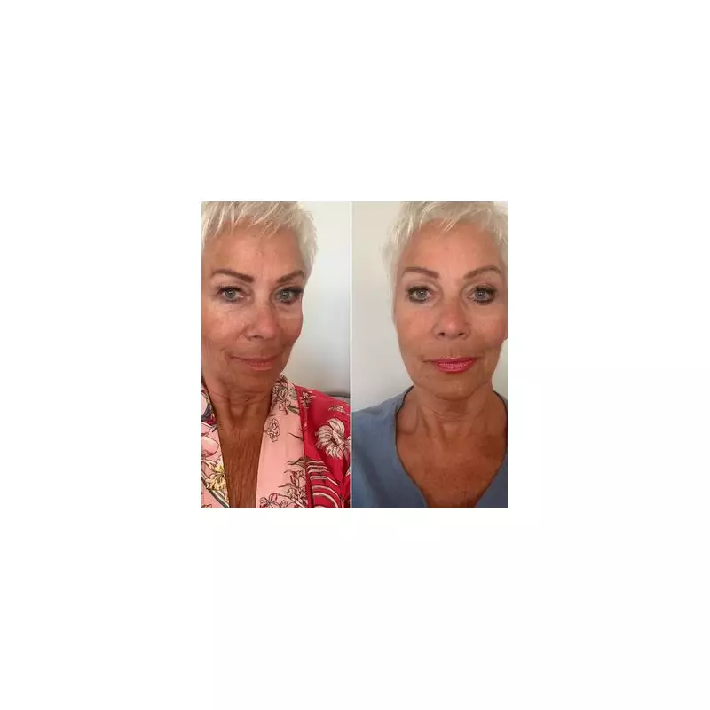 Denise Welch's Neck Serum Transformation: Loose Skin Gone in 6 Weeks?