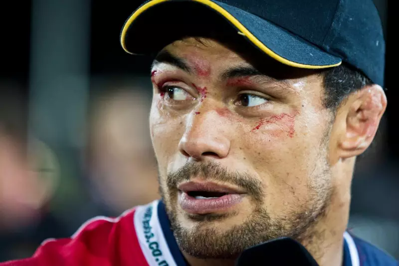 Former Rugby Star's Tragic Brain Injury Sparks Urgent Call for Sport Safety Reform