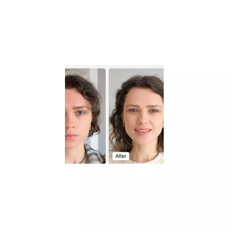 Glow Up For Less! LED Face Mask Slashed to £59.99 in Unmissable Deal