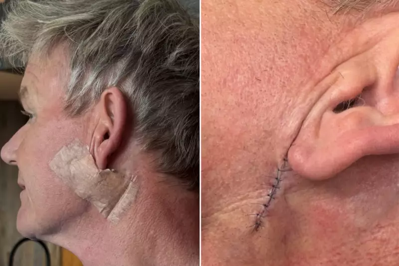 Gordon Ramsay's Skin Cancer Shock: Chef's Urgent Health Warning After Basal Cell Carcinoma Diagnosis
