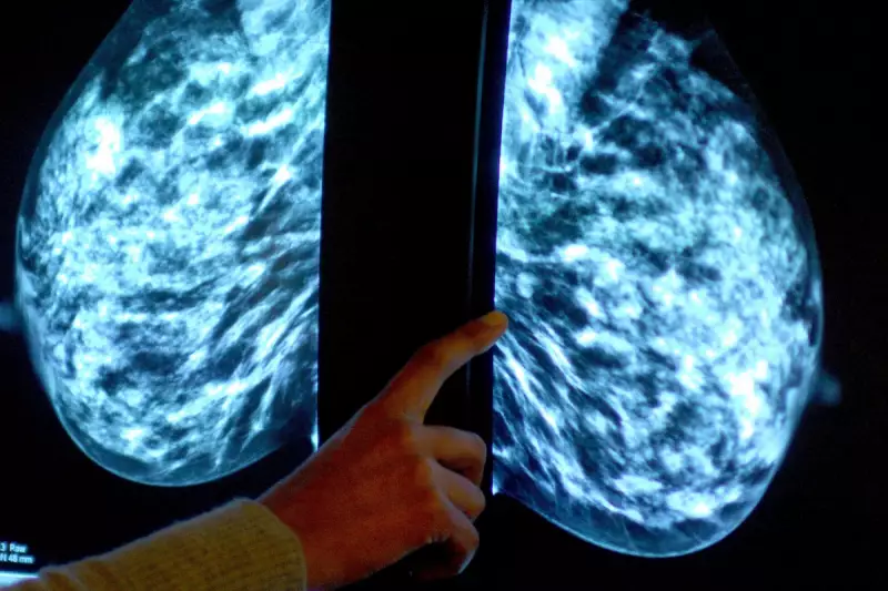Mammograms Could Predict Heart Attack Risk, Groundbreaking Study Reveals