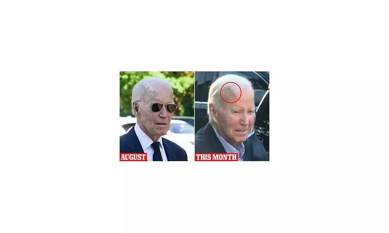 President Biden Undergoes Successful Surgery to Remove Skin Cancer Lesion