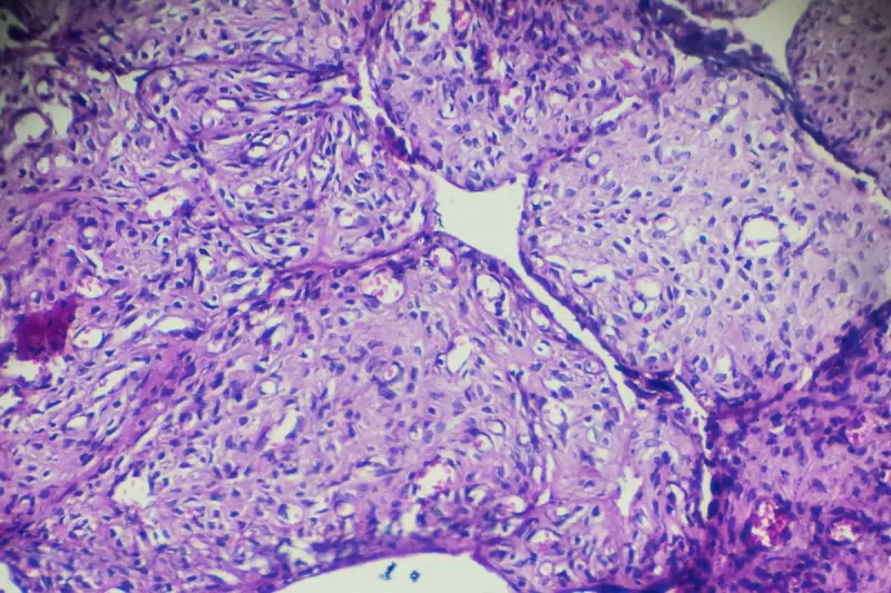 Revolutionary Blood Test for Ovarian Cancer to Transform Early Detection on NHS