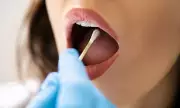 Breakthrough Link Found: Gum Disease Bacteria Could Signal Increased Pancreatic Cancer Risk