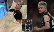Dave Hughes Health Scare: Comedian's Brutal AFL Charity Match Leaves Him With Five Broken Ribs and Punctured Lung
