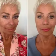 Denise Welch's Neck Serum Transformation: Loose Skin Gone in 6 Weeks?
