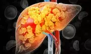 Liver Disease Breakthrough: Scientists Uncover Hidden Risk Factors Beyond Alcohol