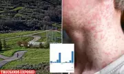 Measles Outbreak Alert: Thousands Exposed at Major UK Sporting Event as Cases Surge