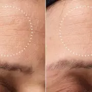 Medik8's At-Home Chemical Peel Kit Slashed by 50% in Unmissable Skincare Deal