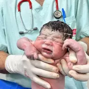 Miracle Baby Defies Odds: Newborn Arrives Clutching Mother's Lost Contraceptive Coil