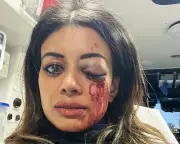 NSW Police Officer Charged Over Sydney Pro-Palestine Protest Assault Leaving Woman With Eye Injury