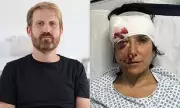 Outrage as Cyclist Who Shattered Woman's Skull in London Hit-and-Run Escapes with Paltry £100 Fine