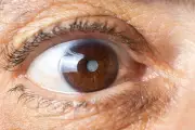 Revolutionary NHS Study Reveals: Two Cataract Surgeries Transform Lives, Slashing Fall Risks by 38%